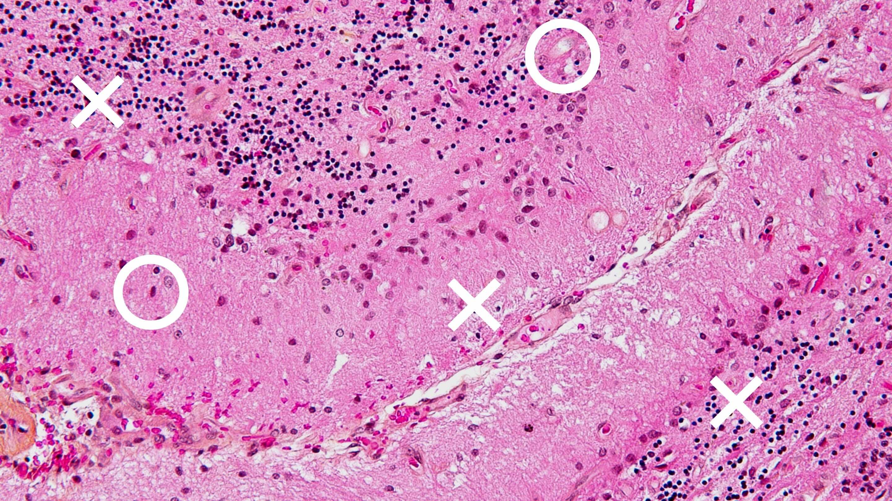 Segmentum image of a blood sample on a slide